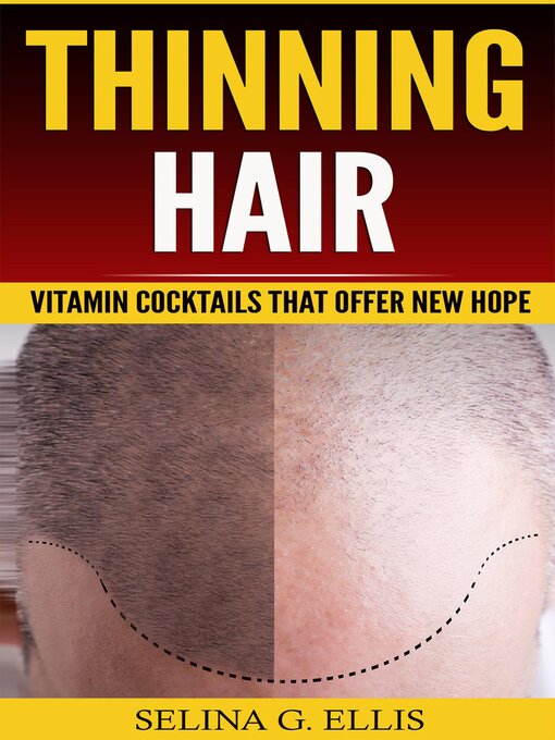 Title details for Thinning Hair by Selina G Ellis - Wait list